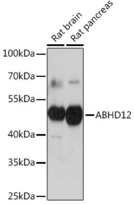 Western Blot ABHD12 Antibody - Azide and BSA Free