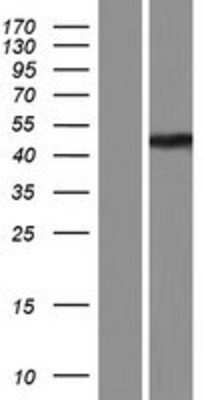 Western Blot: ABHD12 Overexpression Lysate (Adult Normal) [NBP2-08371] Left-Empty vector transfected control cell lysate (HEK293 cell lysate); Right -Over-expression Lysate for ABHD12.