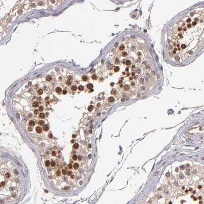 Immunohistochemistry-Paraffin: ABHD12B Antibody [NBP1-88669] - Staining of human testis shows strong nuclear positivity in cells of seminiferus ducts.