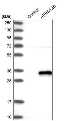 Western Blot ABHD12B Antibody - BSA Free