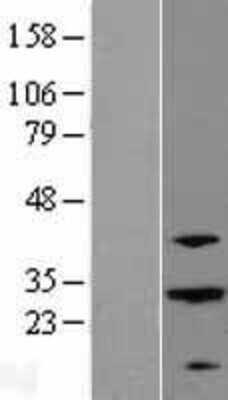 Western Blot: ABHD12B Overexpression Lysate (Adult Normal) [NBL1-07191] Left-Empty vector transfected control cell lysate (HEK293 cell lysate); Right -Over-expression Lysate for ABHD12B.