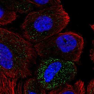 Immunocytochemistry/Immunofluorescence: ABHD14A Antibody [NBP2-55281] - Staining of human cell line PC-3 shows localization to vesicles.