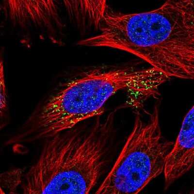 Immunocytochemistry/Immunofluorescence: ABHD14A Antibody [NBP2-58749] - Staining of human cell line U-251 MG shows localization to vesicles.