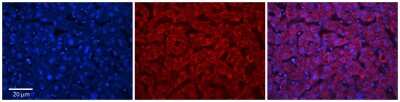 Immunohistochemistry-Paraffin: ABHD14A Antibody [NBP2-84375] - Rabbit Anti-ABHD14A Antibody. Formalin Fixed Paraffin Embedded Tissue: Human Adult Liver. Observed Staining: Cytoplasm in hepatocytes, strong signal, wide tissue distribution. Primary Antibody Concentration: 1:100. Secondary Antibody: Donkey anti-Rabbit-C