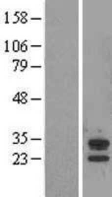 Western Blot: ABHD14A Overexpression Lysate (Adult Normal) [NBL1-07193] Left-Empty vector transfected control cell lysate (HEK293 cell lysate); Right -Over-expression Lysate for ABHD14A.