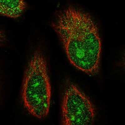 Immunocytochemistry/Immunofluorescence: ABHD14B Antibody [NBP1-84472] - Immunofluorescent staining of human cell line U-2 OS shows localization to nucleus, nucleoli &amp; cytosol.