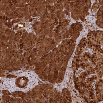 Immunohistochemistry-Paraffin: ABHD14B Antibody [NBP1-84472] - Staining of human pancreas shows strong cytoplasmic and nuclear positivity in exocrine glandular cells and islet cells.