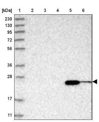 Western Blot: ABHD14B Antibody [NBP1-84472] - Lane 1: Marker  [kDa] 230, 130, 95, 72, 56, 36, 28, 17, 11.  Lane 2: Human cell line RT-4.  Lane 3: Human cell line U-251MG sp.  Lane 4: Human plasma (IgG/HSA depleted).  Lane 5: Human liver tissue.  Lane 6: Human tonsil tissue