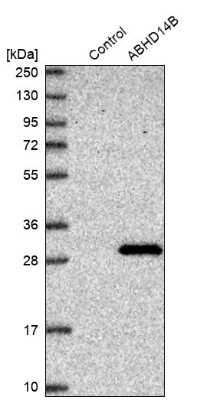Western Blot ABHD14B Antibody - BSA Free