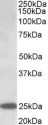 Western Blot ABHD14B Antibody