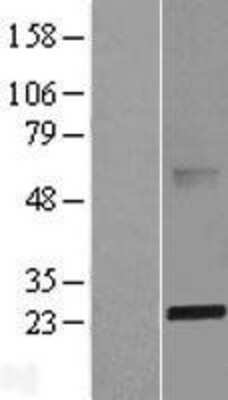 Western Blot ABHD14B Overexpression Lysate