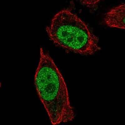 Immunocytochemistry/ Immunofluorescence ABHD16B Antibody