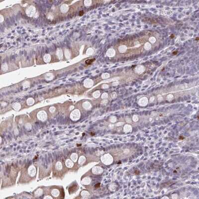 Immunohistochemistry-Paraffin ABHD16B Antibody