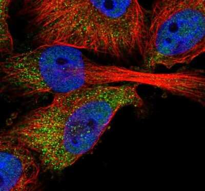 Immunocytochemistry/Immunofluorescence: ABHD2 Antibody [NBP1-82850] - Staining of human cell line U-251 MG shows localization to nucleoplasm & cytosol. Antibody staining is shown in green.