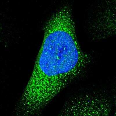 Immunocytochemistry/ Immunofluorescence ABHD3 Antibody - BSA Free