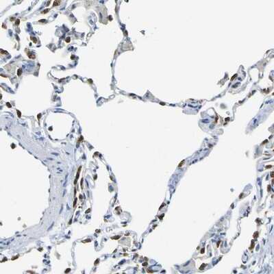 Immunohistochemistry-Paraffin ABHD3 Antibody - BSA Free