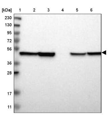 Western Blot ABHD3 Antibody - BSA Free