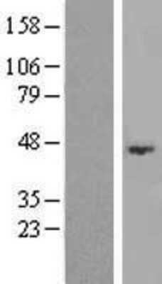 Western Blot: ABHD3 Overexpression Lysate (Adult Normal) [NBL1-07197] Left-Empty vector transfected control cell lysate (HEK293 cell lysate); Right -Over-expression Lysate for ABHD3.