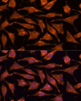 Immunocytochemistry/Immunofluorescence: ABHD4 Antibody [NBP3-15550] - Immunofluorescence analysis of L929 cells using ABHD4 antibody (NBP3-15550) at dilution of 1:100. Blue: DAPI for nuclear staining.