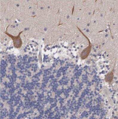 Immunohistochemistry-Paraffin ABHD4 Antibody