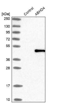 Western Blot ABHD4 Antibody