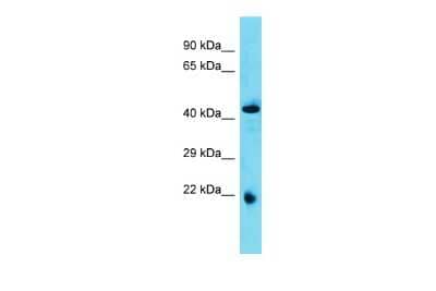 Western Blot: ABHD4 Antibody [NBP2-84378] - Host: Rabbit. Target Name: Abhd4. Sample Type: Rat Pancreas lysates. Antibody Dilution: 1.0ug/ml