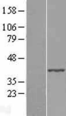 Western Blot: ABHD4 Overexpression Lysate (Adult Normal) [NBL1-07198] Left-Empty vector transfected control cell lysate (HEK293 cell lysate); Right -Over-expression Lysate for ABHD4.