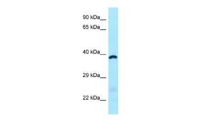 Western Blot: ABHD6 Antibody [NBP2-82552] - WB Suggested Anti-ABHD6 Antibody. Titration: 1.0 ug/ml. Positive Control: Fetal Heart