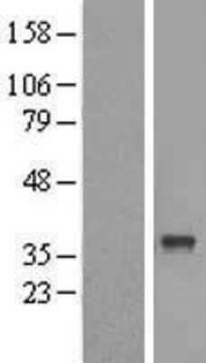 Western Blot: ABHD6 Overexpression Lysate (Adult Normal) [NBL1-07200] Left-Empty vector transfected control cell lysate (HEK293 cell lysate); Right -Over-expression Lysate for ABHD6.