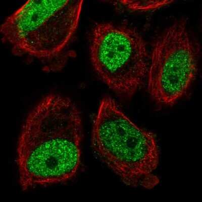 Immunocytochemistry/ Immunofluorescence ABHD8 Antibody - BSA Free