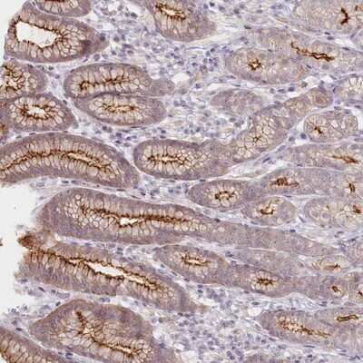 Immunohistochemistry-Paraffin ABHD8 Antibody - BSA Free