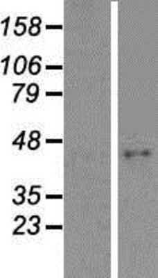 Western Blot: ABHD9 Overexpression Lysate (Adult Normal) [NBP2-06283] Left-Empty vector transfected control cell lysate (HEK293 cell lysate); Right -Over-expression Lysate for ABHD9.