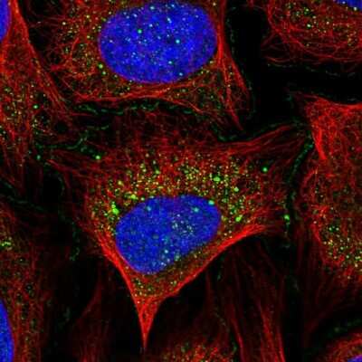 Immunocytochemistry/Immunofluorescence: ABI1 Antibody [NBP2-56144] - Staining of human cell line U-2 OS shows localization to plasma membrane, cytosol & cell junctions.