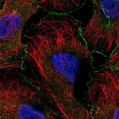 Immunocytochemistry/Immunofluorescence: ABI1 Antibody [NBP2-57842] - Staining of human cell line U-2 OS shows localization to plasma membrane & cell junctions. Antibody staining is shown in green.