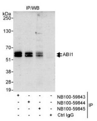 Immunoprecipitation: ABI1 Antibody [NB100-59843] - Detection of Human ABI1 on HeLa whole cell lysate using NB100-59843. ABI1 was also immunoprecipitated by rabbit anti-ABI1 antibodies NB100-59844 and NB100-59845.