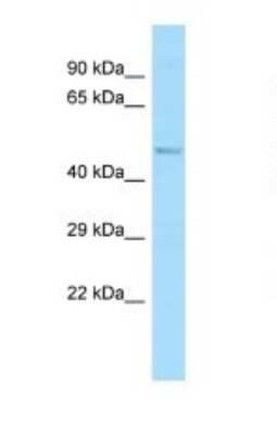 Western Blot: ABI1 Antibody [NBP1-98306] - Titration: 1.0 ug/ml Positive Control: Rat Brain.