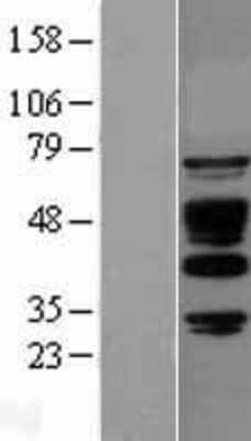 Western Blot: ABI1 Overexpression Lysate (Adult Normal) [NBL1-07203] Left-Empty vector transfected control cell lysate (HEK293 cell lysate); Right -Over-expression Lysate for ABI1.