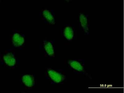 Immunocytochemistry/Immunofluorescence: ABI2 Antibody [H00010152-B01P] - Analysis of purified antibody to ABI2 on HeLa cell. (antibody concentration 10 ug/ml)