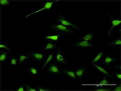Immunocytochemistry/Immunofluorescence: ABI2 Antibody [H00010152-D01P] - Analysis of antibody to ABI2 on HeLa cell. Antibody concentration 30 ug/ml.