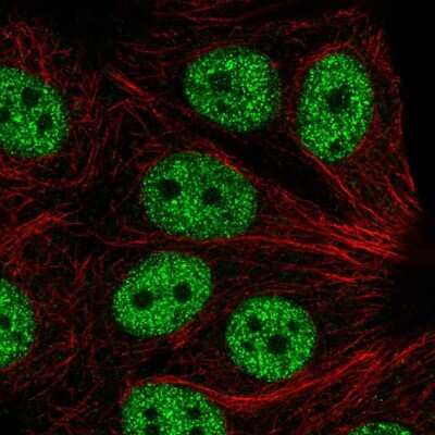 Immunocytochemistry/Immunofluorescence: ABI2 Antibody [NBP2-56014] - Staining of human cell line MCF7 shows localization to nucleoplasm.