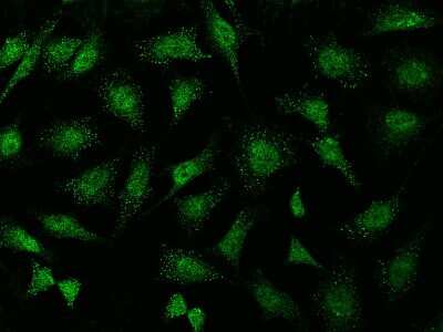 Immunocytochemistry/Immunofluorescence: ABI2 Antibody [NBP2-99345] - Immunofluorescence staining of ABI2 in Hela cells. Cells were fixed with 4% PFA, permeabilzed with 0.1% Triton X-100 in PBS, blocked with 10% serum, and incubated with rabbit anti-Human ABI2 polyclonal antibody (dilution ratio 1:1000) at 4C overnight. Then cells were stained with the Alexa Fluor(R)488-conjugated Goat Anti-rabbit IgG secondary antibody (green). Positive staining was localized to cytoplasm and nucleus.