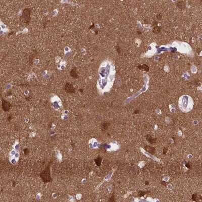 <b>Orthogonal Strategies Validation. </b>Immunohistochemistry-Paraffin: ABI2 Antibody [NBP2-49637] - Staining of human cerebral cortex shows high expression.