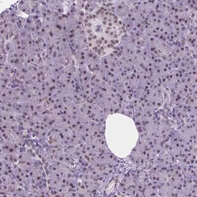 Immunohistochemistry-Paraffin: ABI2 Antibody [NBP2-49637] - Staining of human pancreas shows low expression as expected.