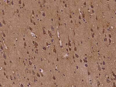 Immunohistochemistry-Paraffin: ABI2 Antibody [NBP2-98107] - Immunochemical staining of human ABI2 in human brain with rabbit polyclonal antibody at 1:100 dilution, formalin-fixed paraffin embedded sections.