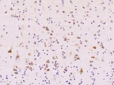 Immunohistochemistry-Paraffin: ABI2 Antibody [NBP2-99345] - Immunochemical staining of human ABI2 in human brain with rabbit polyclonal antibody at 1:1000 dilution, formalin-fixed paraffin embedded sections.