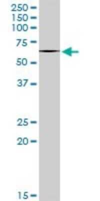 Western Blot: ABI2 Antibody [H00010152-B01P] - Analysis of ABI2 expression in Jurkat.