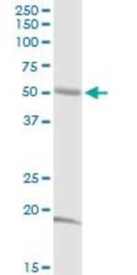 Western Blot: ABI2 Antibody [H00010152-D01P] - Analysis of ABI2 expression in human kidney.