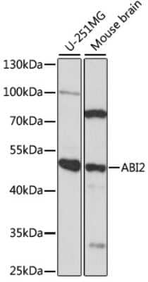 Western Blot: ABI2 Antibody [NBP2-92201] - Analysis of extracts of various cell lines, using ABI2 at 1:1000 dilution.Secondary antibody: HRP Goat Anti-Rabbit IgG (H+L) at 1:10000 dilution.Lysates/proteins: 25ug per lane.Blocking buffer: 3% nonfat dry milk in TBST.Detection: ECL Basic Kit .Exposure time: 90s.