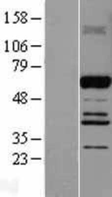 Western Blot: ABI2 Overexpression Lysate (Adult Normal) [NBL1-07205] Left-Empty vector transfected control cell lysate (HEK293 cell lysate); Right -Over-expression Lysate for ABI2.