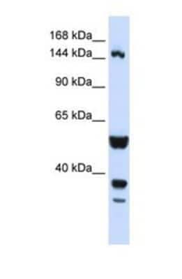 Western Blot:TARSH  Antibody [NBP1-69394] - This  antibody was used in Western Blot of Hela tissue lysate at a concentration of 1ug/ml.